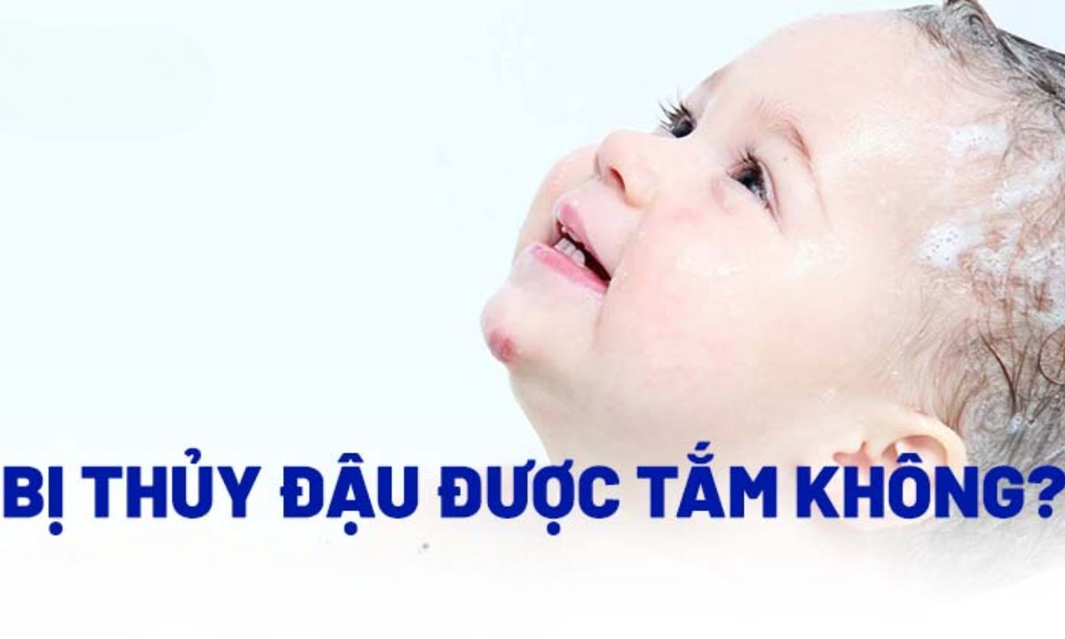 Bị thủy đậu có được tắm không?