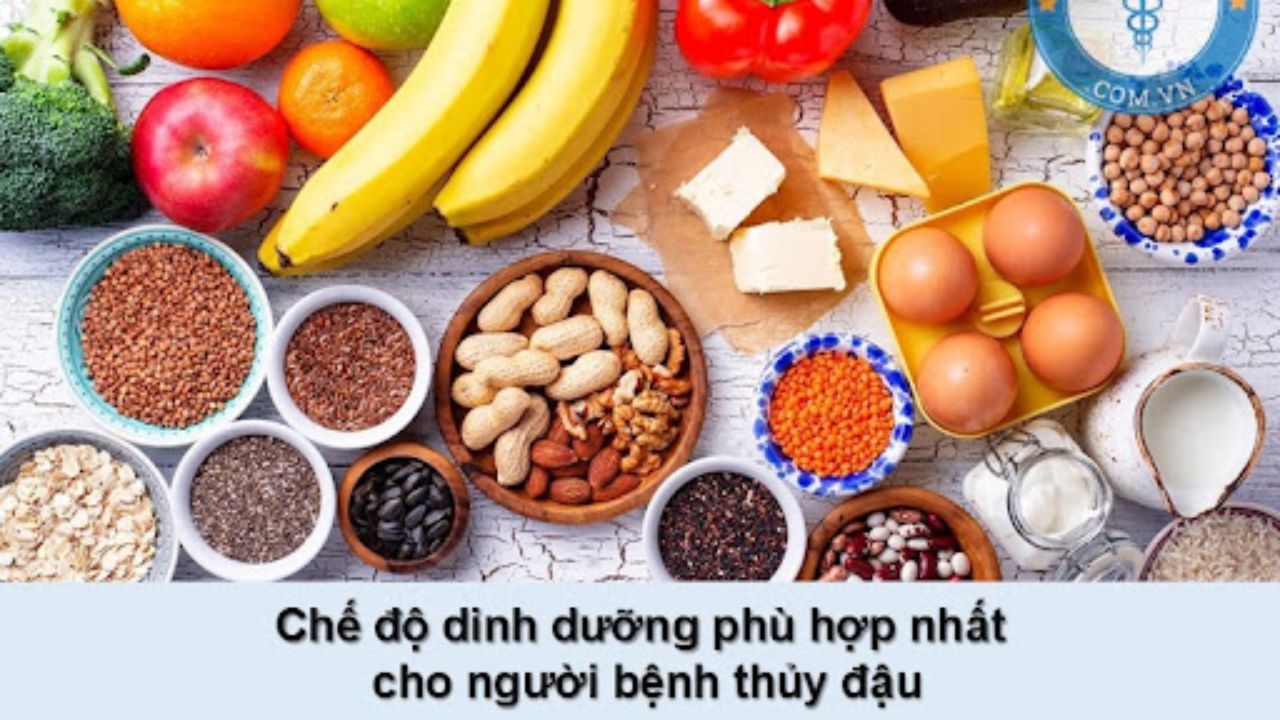 Nên làm gì để rút ngắn thời gian xuất hiện dấu hiệu bệnh thủy đậu sắp khỏi?